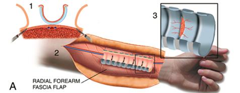 Trachea