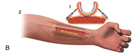 Trachea